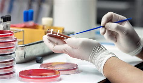 antimicrobial testing lab philippines